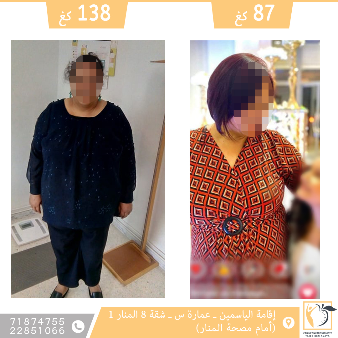 -51 KG
